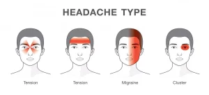 Headache-type-Gray